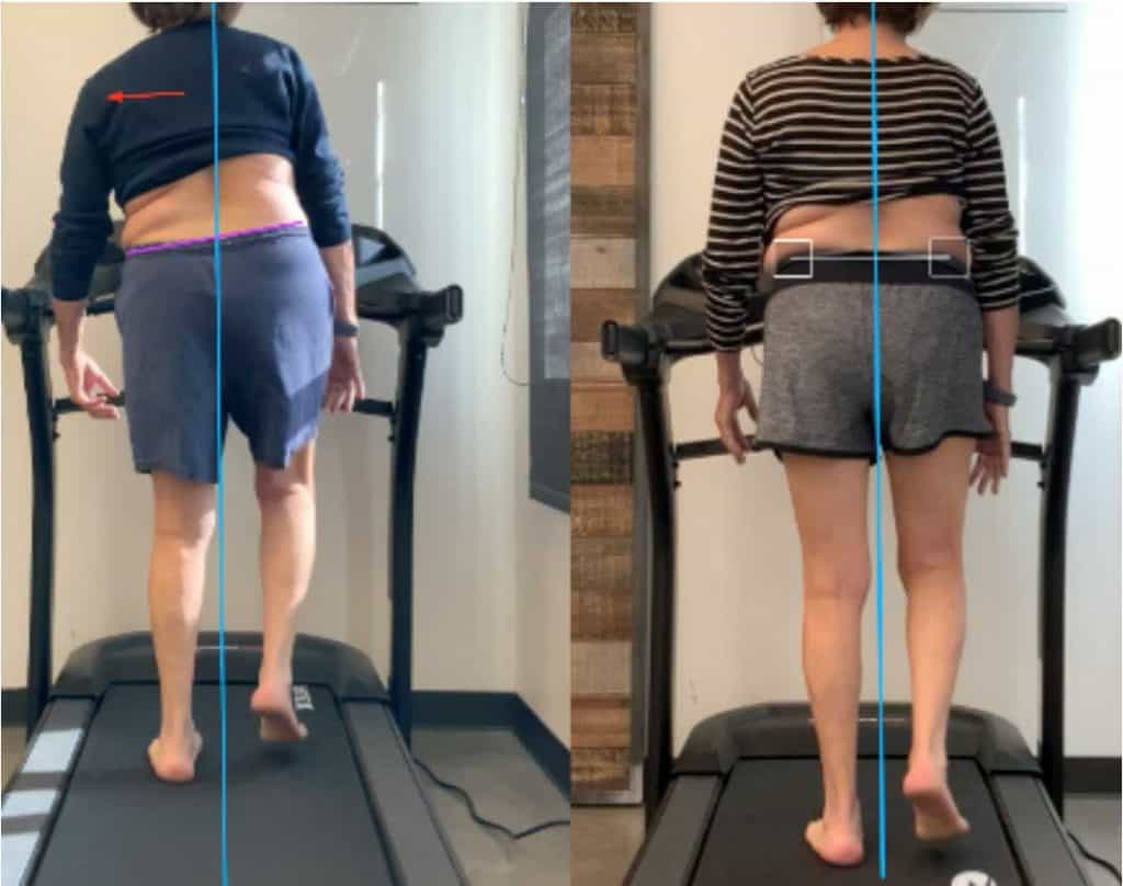 Video Gait Assessment – Boulder PT